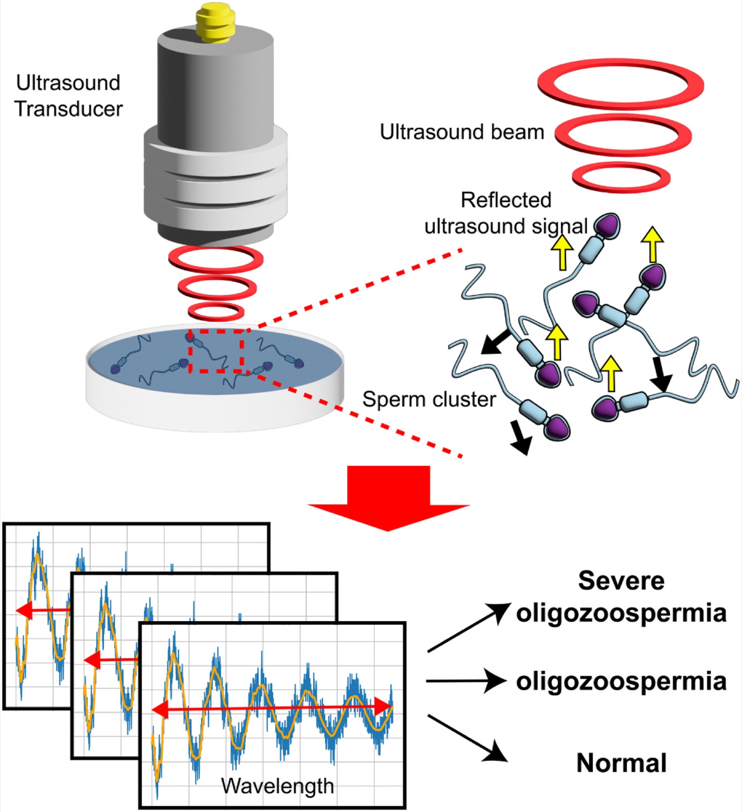 Ultrasound sperm quantification and wavelength classification