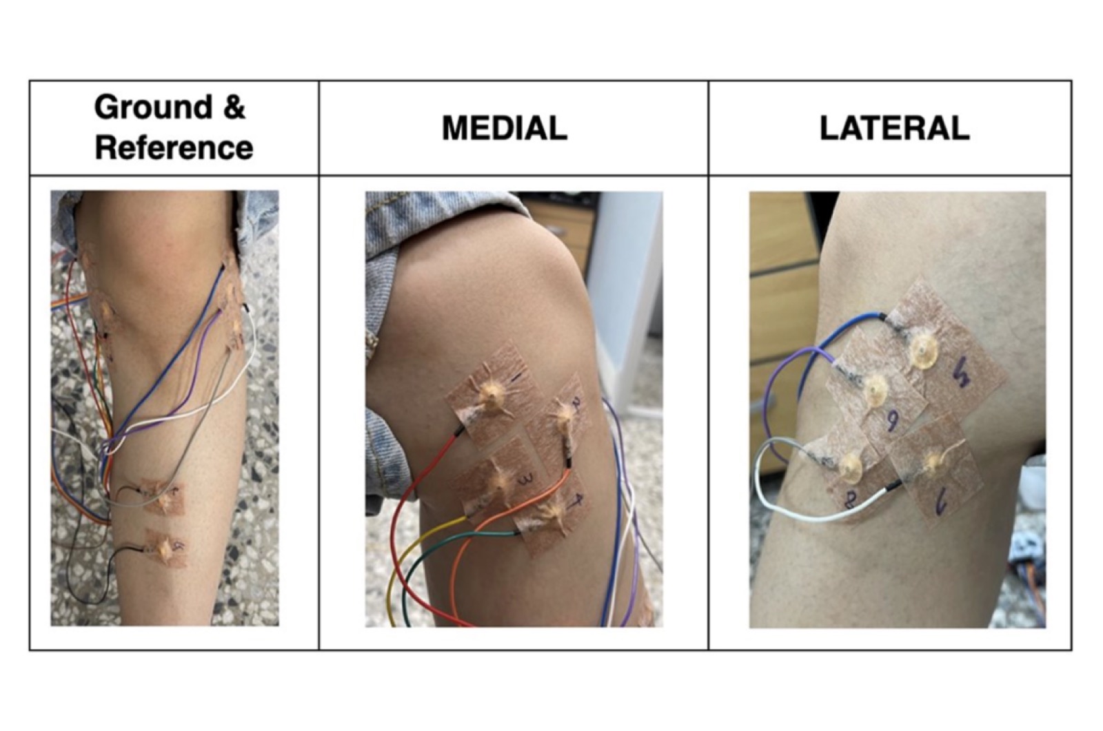EAG(Electroarthrography)